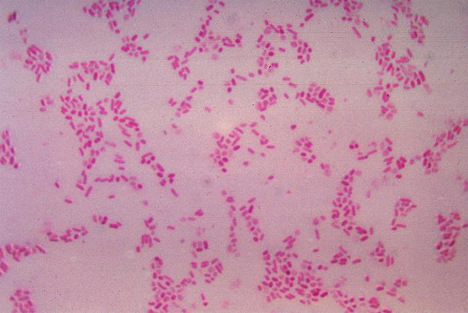 ϸϸϸ(Bacteroides fragilis)