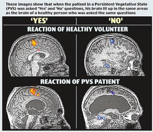 英发现通过核磁共振成像可与植物人沟通