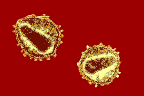 人体免疫缺损病毒/获得性免疫缺陷综合症(HIV/AIDS)