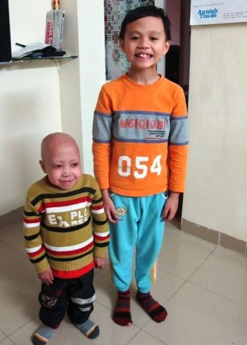 越南15岁少年杜文勇(左)和他10岁的弟弟。