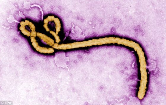中国专家组赴非阻击埃博拉：已掌握抗体基因埃博拉埃博拉抗体