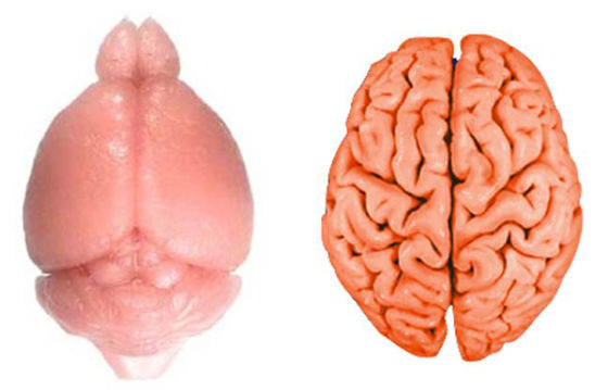 研究揭示大脑褶皱取决于灰质生长速度和厚度大脑皮层沟回褶皱