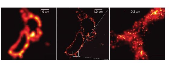 图5：中间图像为溶酶体膜（lysosome membranes），是埃里克•白兹格（Eric Betzig）首次使用单分子显微镜拍摄的图片之一。从中选取0.2微米的阿贝衍射极限大小显示在右边。左边为用传统显微镜拍摄的图片，可以看出图片分辨率提高了很多倍。