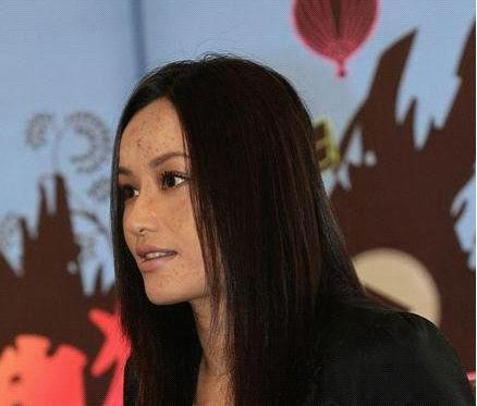 瞿颖内调祛痘有绝招