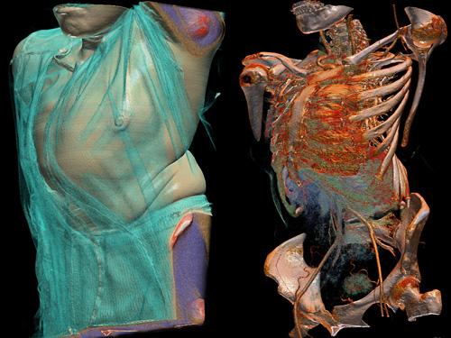 奇妙三維CT照片透視人體和動物內部奧秘圖片2