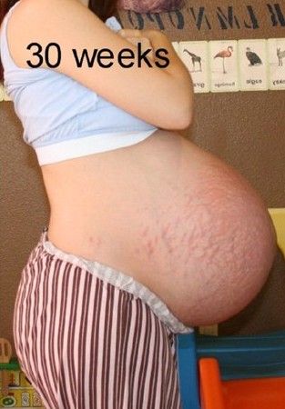 怀孕30周时
