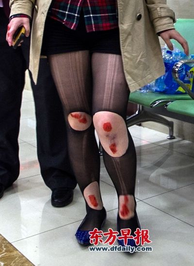 一名受伤乘客在上海市静安区中心医院接受治