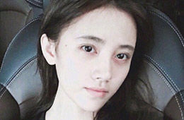 为什么无论睡多久黑眼圈还是如影随形