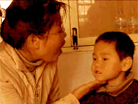 王娟:帮助聋哑孩子恢复语言