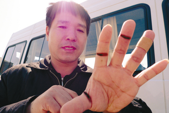 刀割破手指_脉被刀割破失血身亡