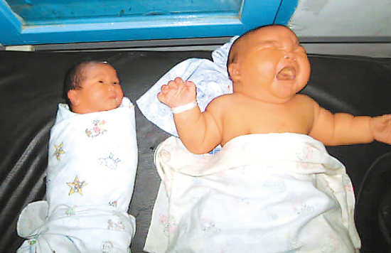 强！印尼妇女产下８.７千克巨婴