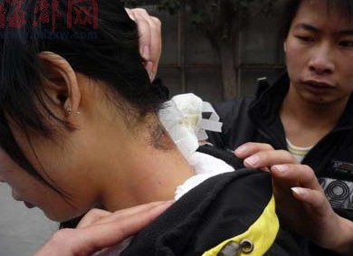 泉州妙龄女爱漂亮去美发店<em>烫头发</em> 药水灼伤脖