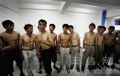 云南24名矿工染矽肺病未签合同难以维权