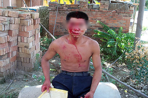 [图]湖北百余农民工在陕讨薪遭殴打9人重伤