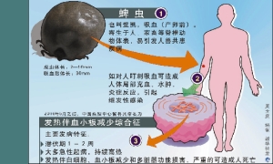 网友疯狂“搜蜱”日捉500只