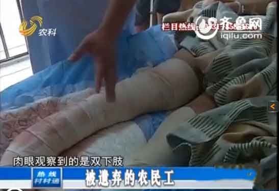 菏泽25岁小伙打工受伤腿内生蛆绝望一家渴求救助