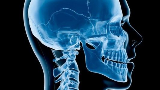 意科学家发现新方法未来可实现人体头颅移植