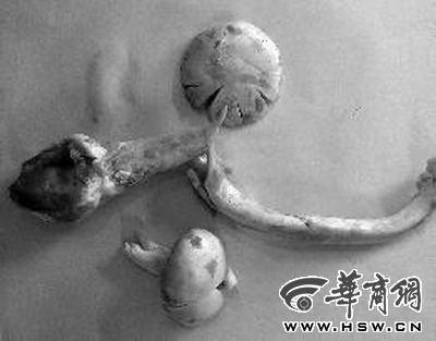 文县有多少人口_文县天池图片(2)