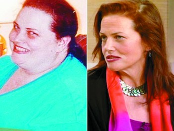 胖女减去200公斤赘肉