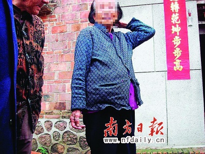 82岁老太婆卵巢肿瘤像怀孕