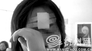 女孩两次在同一路公交车上因紧急刹车受伤