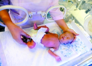 三胞胎将获早产儿基金救助