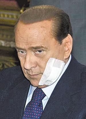 老贝整容后绷着脸亮相