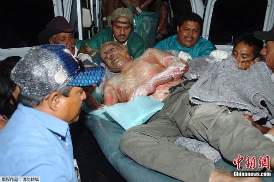 �鶼��˹����������ʬ�ٶ�������ŭ��̫ƽ��