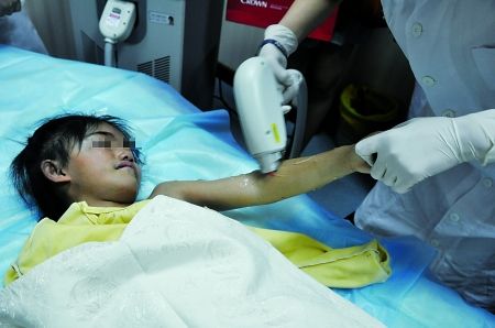 除毛用手揪铜梁“毛孩”不怕痛