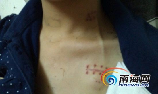 ����Ů��ѧ�����񼲰��½���4ǧԪ����ξ���