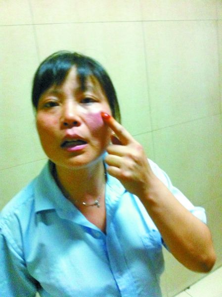 郑州两小偷辣椒水喷众人 十几人受伤大面积发
