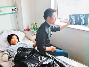 被玉米收获机咬住手农妇挥镰刀断臂自救