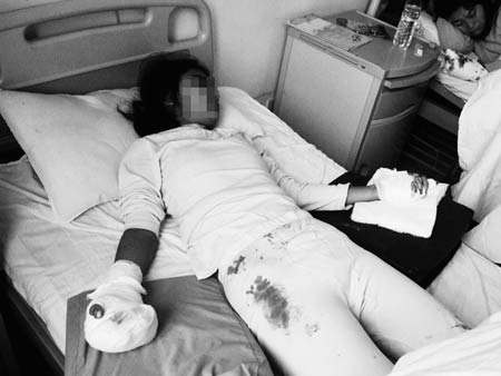 15岁女生夜晚遇歹徒双手夺利刃脱身