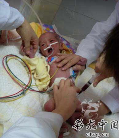垂危病婴险被父亲活埋弃置野外39小时(图)