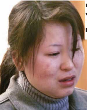 兽医误将兽用疫苗注入女子体内致其被迫流产
