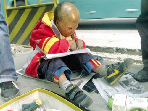 "一个五六岁被破相,双眼被挖掉"的小孩在乞讨.