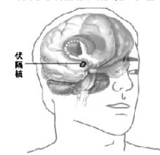 男子因压力一天喝49瓶啤酒被迫做手术