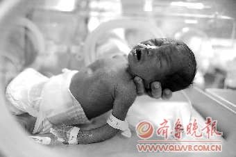 四个小家伙全部在新生儿监护室的暖箱里接受治疗。本报记者 王媛 摄