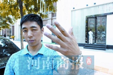 张小利说，他现在左眼情况很差，离这么近，也看不清自己的手 河南商报记者 王春胜/摄