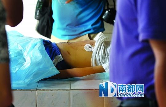 ��ҽ�����ܣ����߸�������Ƣ�ܵ����������ˡ� �϶����� ���ĸ� ��