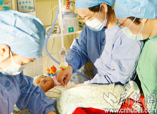 图为：术后，医生仍在重点监护小天佑