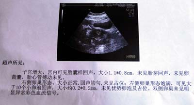 报告都表明,肖女士是宫内孕初诊病历上,写着"宫外孕"字样台海网9月1日