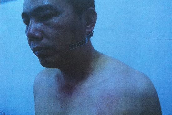 邓升民向早报记者提供了医院的验伤证明，并称，“检方对我进行了殴打，我随时可以出庭作证。”
