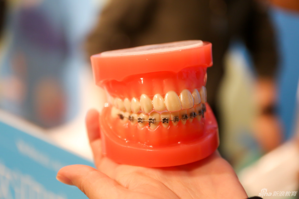 这种智齿赶紧拔了千万别犹豫