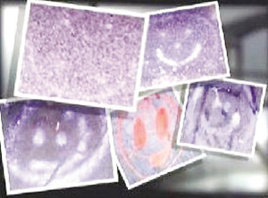 美11年苦追笑脸杀手