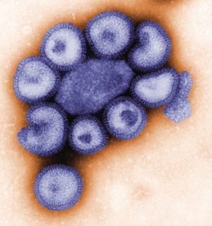 从未见过的猪流感病毒横扫墨西哥美国致死68人