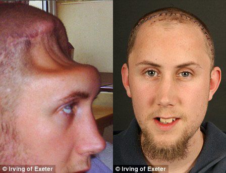 Ӣ������1/4­�����ݿֲ�����(ͼ)