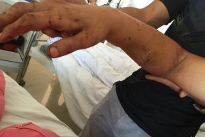 高三班长疑未组织送礼被老师关办公室毒打(图)