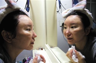 整容手术让陈怡丽鼻子发炎及畸形，嘴唇不对称，别扭的五官让她看上去苍老了十岁。