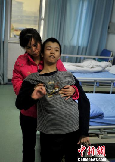 英一男子患罕见病致面目扭曲仍乐观激励病友